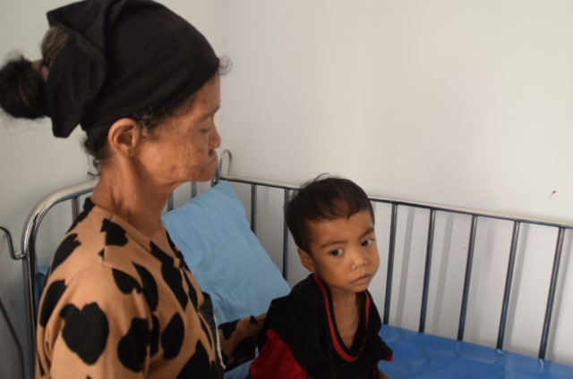 Mengalami Gizi Buruk, Seorang Anak Usia 6 Tahun Di Buton Tengah Beratnya hanya 10 Kg