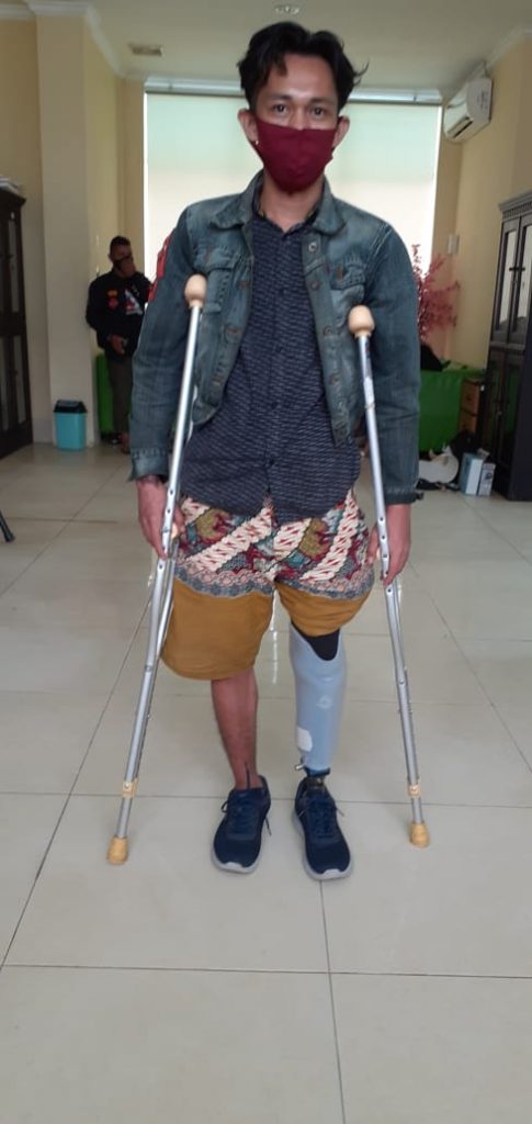 Karyawan VDNI Kecelakaan Kerja, BPJamsostek Sultra Beri Bantuan Kaki Palsu