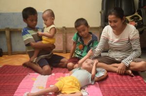 Seorang Balita Di Buton Menderita Hidrosefalus dan Gizi Buruk, Orangtua Mengaku Tak Punya Uang Biaya Pengobatan