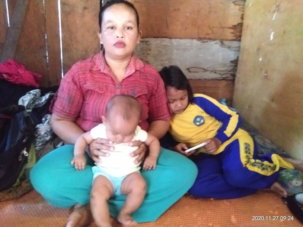 Lusi Oktavia Ristiana Gadis Cilik Tanpa Anus Butuh Bantuan