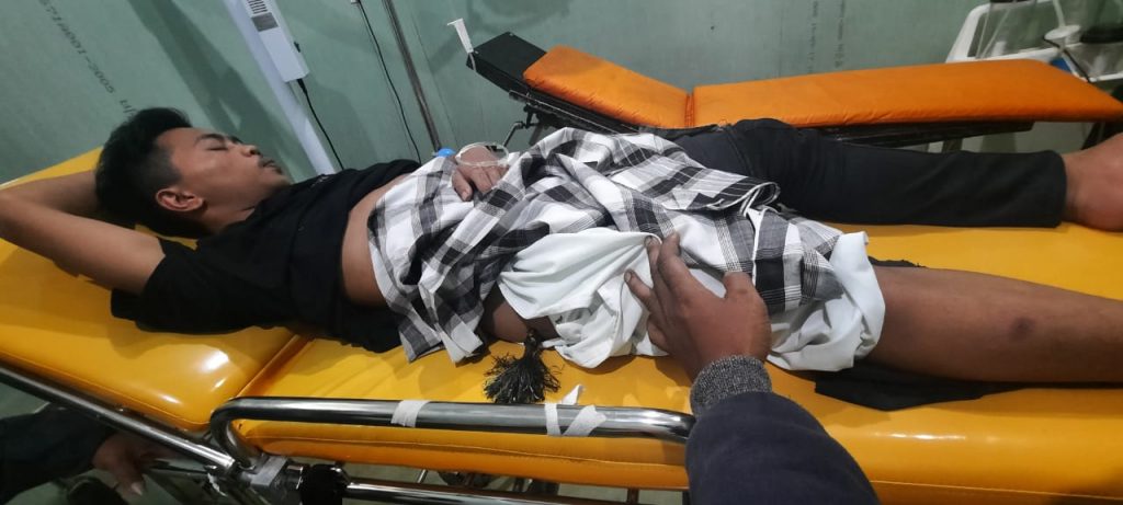 Seorang Pemuda Liabuku Diserang OTK Dengan Busur