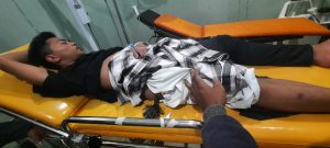 Seorang Pemuda Liabuku Diserang OTK Dengan Busur