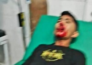 Asyik Mabar, Dua Remaja Lelaki Diparangi OTK