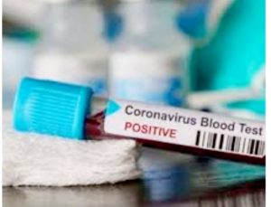 35 Karyawan Perusahaan Tambang Aspal di Buton Positif Corona