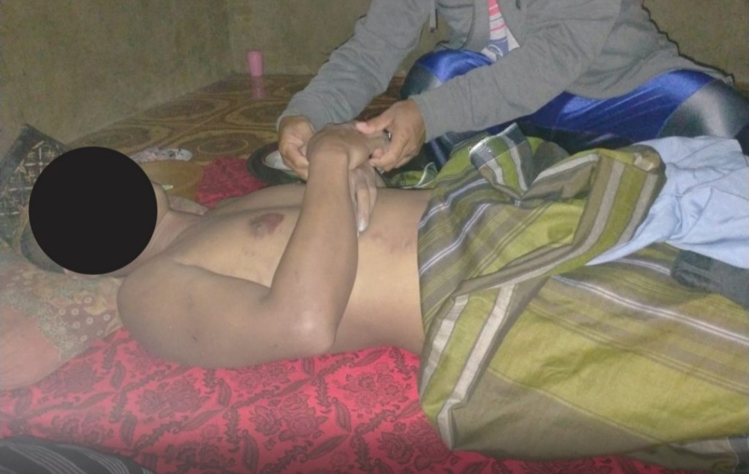 Panah Ikan di Laut, Warga Buton Diterkam Buaya
