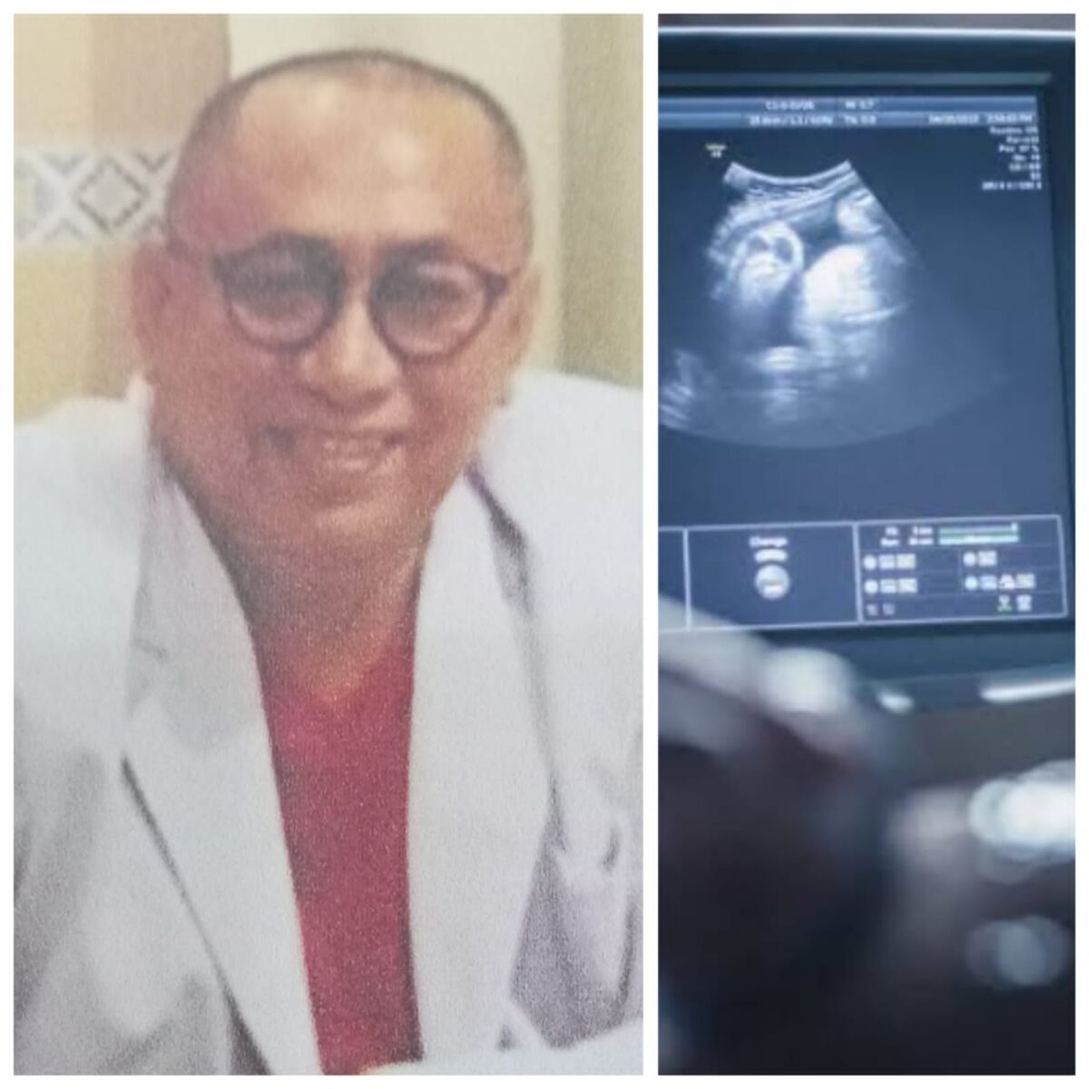 Klinik Utama Zafira Baubau Layani USG Gratis pada Hari Jum'at