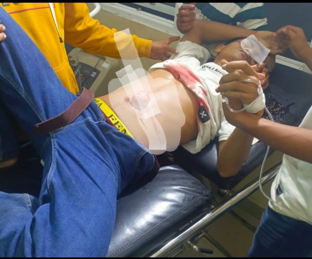 Pria di Buton Ditikam saat Menonton Acara Joget